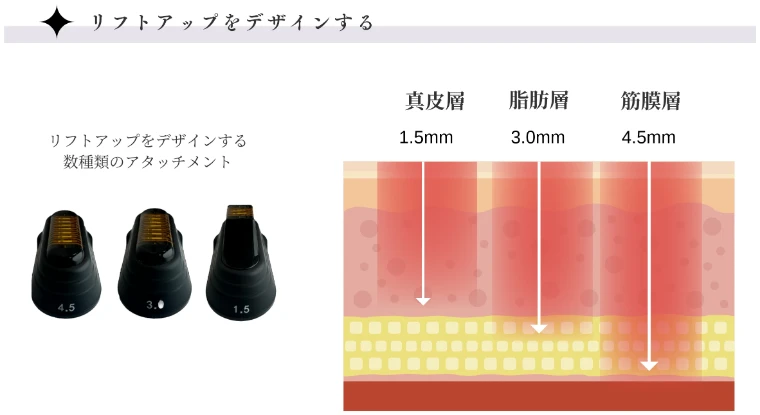 真皮層1.5mm・脂肪層3.0mm・筋膜層4.5mmを撃ち分けるアタッチメントの図