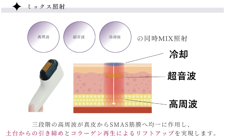 高周波・超音波・冷却波の同時MIX照射の図
